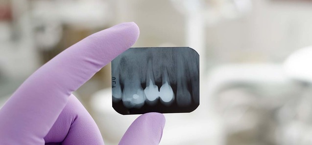 implantes_dentales